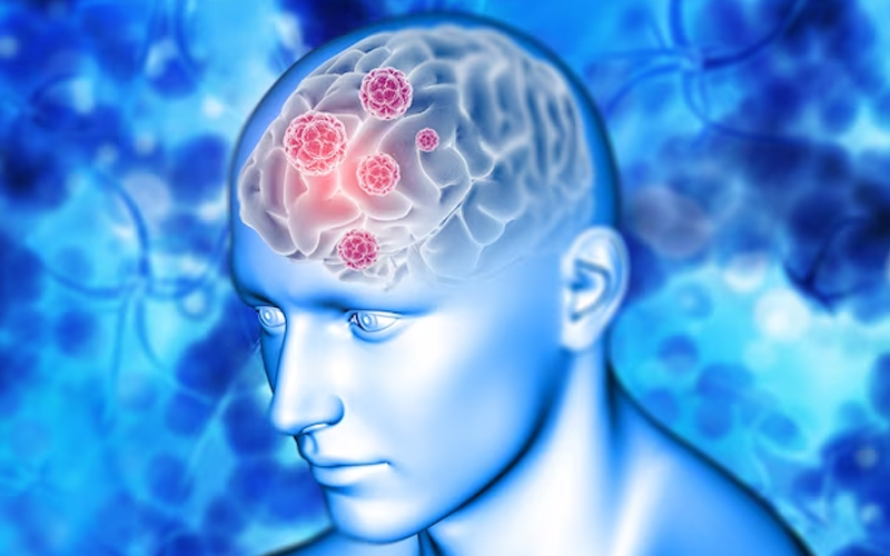 Are supplements the only way to enhance brain function